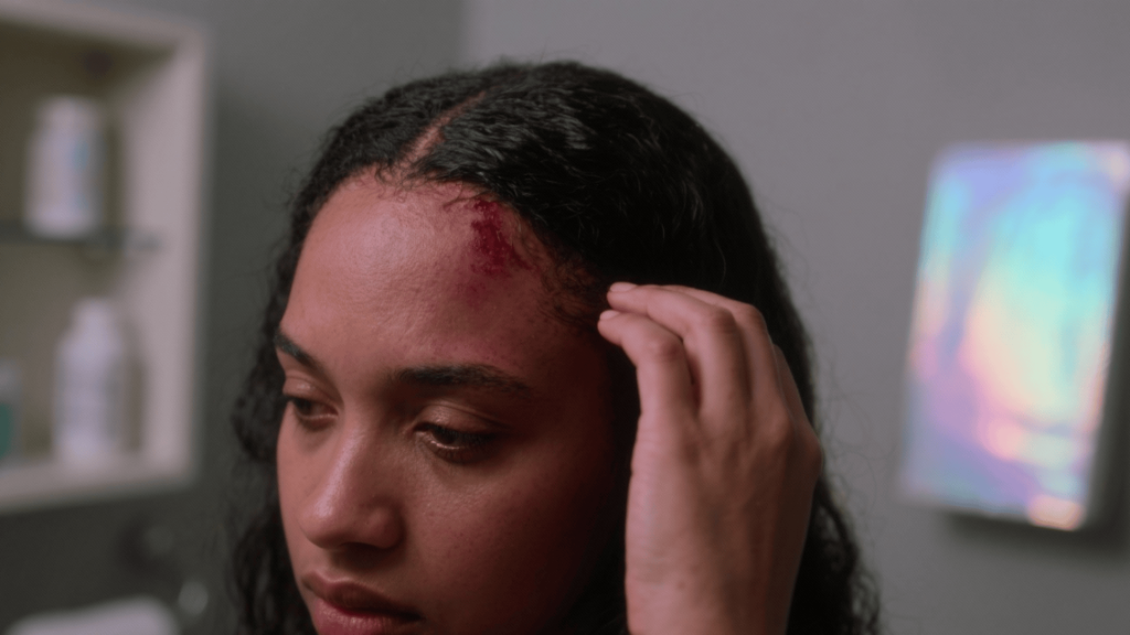 Irritation from productsallergies